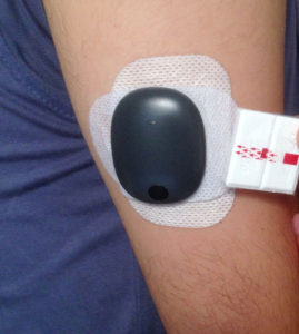 Diabetes — Eversense CGM Transmitter 